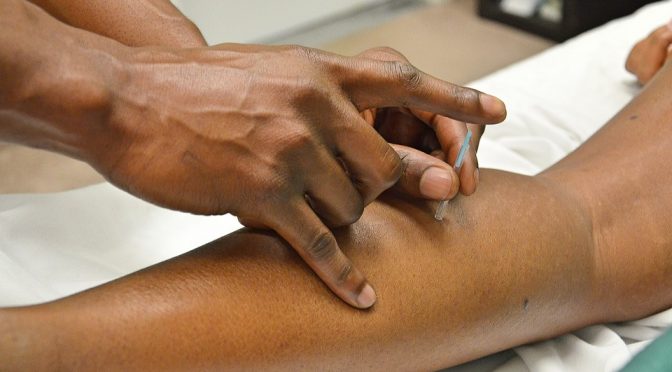 Chinese Acupuncture Germantown Treatment