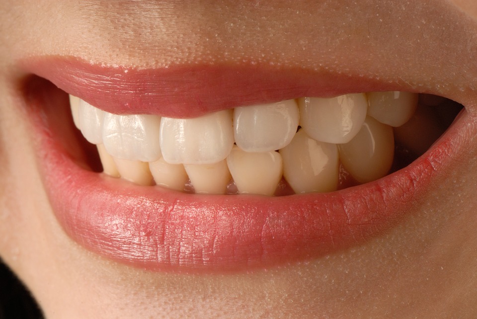 About Teeth Veneers Pricing