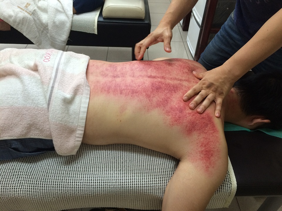 What Is Gua Sha And What Are Its Benefits?