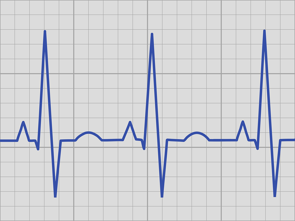 Heart Palpitations: What You Need To Know