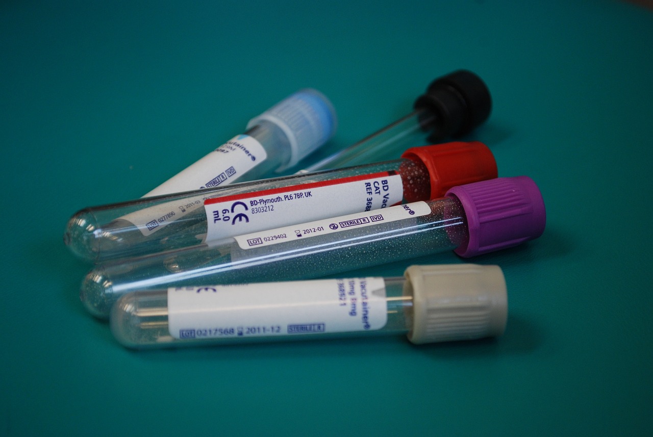 Female Chlamydia Test Kit Different from the Male Version?