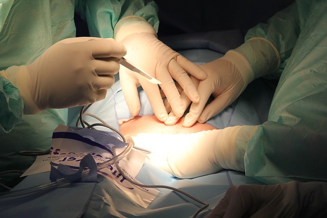 Is Gastric Surgery Sydney Right for You?