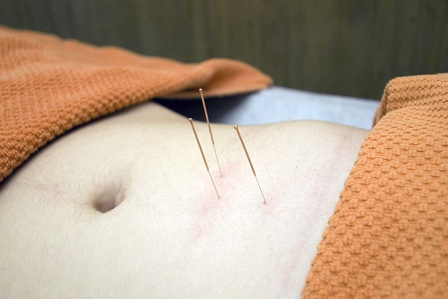 The Amazing Benefits of Acupuncture Broadway